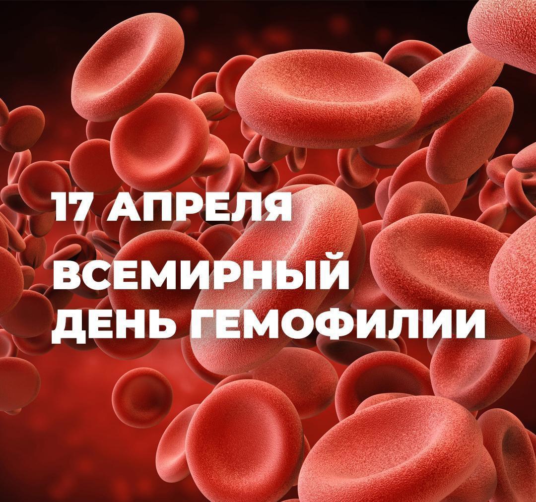 ​​17 апреля — Всемирный день гемофилии